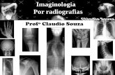 aula 4- Imaginologia por radiografias- Fêmur e cintura pelvica. Profº Claudio Souza