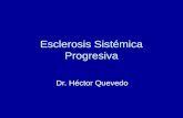 Esclerosis SistéMica Progresiva