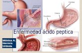 Enfermedad Acido Peptica