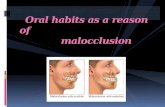 Oral Habits as a Reason of Malocclusion New