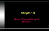 Chapter 11 [blood abnormalities n diseases]