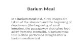 Barium Meal