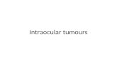 Intraocular Tumours