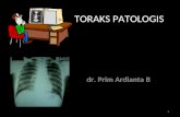 Pp Bimbingan Koas Toraks Patologis Dr. Prim