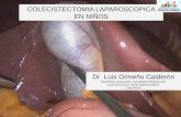 Colecistectomia  laparoscopica en niños