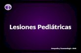 Lesiones pediátricas - Traumatología
