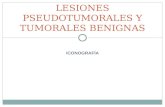 ICONOGRAFÍA LESIONES PSEUDOTUMORALES Y TUMORALES BENIGNAS.