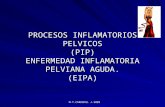 M.T.CARDEMIL J-2009 PROCESOS INFLAMATORIOS PELVICOS (PIP) ENFERMEDAD INFLAMATORIA PELVIANA AGUDA. (EIPA)