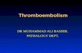 Thromboembolism,pulmonary embolism,general pathology