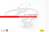 11. Vasculitis . 11. Vasculitis 11.1 Vasculitis leucocitoclástica necrotizante. 11.2 Púrpura de Shönlein-Henoch. 11.3 Enfermedad.