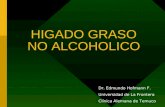 HIGADO GRASO NO ALCOHOLICO Dr. Edmundo Hofmann F. Universidad de La Frontera Clínica Alemana de Temuco.