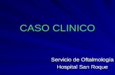 CASO CLINICO Servicio de Oftalmología Hospital San Roque.