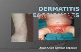 Jorge Arturo Barreras Espinoza. Dermatitis Reacciónales ContactoAlérgicaIrritativaSeborreicaMedicamentosaEccema numular Dermatología, atlas diagnostico.