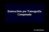 Enteroclisis por Tomografía Computada TR. Furlan Mariano.