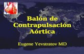 Balón de Contrapulsación Aórtica Eugene Yevstratov MD.