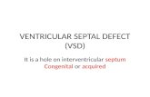 VENTRICULAR SEPTAL DEFECT (VSD) It is a hole on interventricular septum Congenital or acquired.