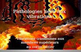 Pathologies liées aux vibrations Vibrations transmises aux membres supérieurs au corps entier.
