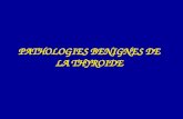 PATHOLOGIES BENIGNES DE LA THYROIDE. CAS CLINIQUE 1.