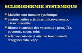 SCLERODERMIE SYSTEMIQUE Maladie auto immune systémique Maladie auto immune systémique atteinte petites artérioles, microvaisseaux, Tissu interstitiel atteinte.
