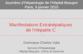 Manifestations Extrahépatiques de lHépatite C Dominique-Charles Valla Service dHépatologie Hôpital Beaujon, Clichy-la Garenne Journées dHépatologie de.