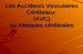 Les Accidents Vasculaires Cérébraux (AVC) ou Attaques cérébrales.