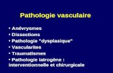Pathologie vasculaire Anévrysmes Dissections Pathologie "dysplasique" Vascularites Traumatismes Pathologie iatrogène : interventionnelle et chirurgicale.