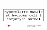 Hyperclarté nucale et hygroma coli à caryotype normal Emmanuel DECROISETTE Claire DUBOIS.