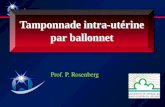 Tamponnade intra-utérine par ballonnet Tamponnade intra-utérine par ballonnet Prof. P. Rosenberg.