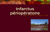 Infarctus périopératoire Gardellin Marianne CHU de Grenoble.