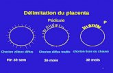 1 Délimitation du placenta Chorion villeux diffus Chorion diffus touffu chorion lisse ou chauve Fin 3è sem 2è mois Pédicule 3è mois P.