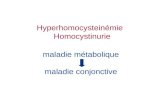 Hyperhomocysteinémie Homocystinurie maladie métabolique maladie conjonctive.