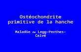 Ostéochondrite primitive de la hanche Maladie de Legg-Perthes-Calvé.