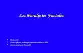 Les Paralysies Faciales Delmont E Centre référent pathologies neuromusculaires et SLA Service professeur Desnuelle.