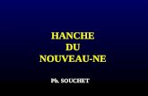 HANCHE DU NOUVEAU-NE Ph. SOUCHET. LUXATION CONGENITALE DE HANCHE MALADIE LUXANTE DE HANCHE.
