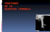 INTRODUCTION  Les fractures de la diaphyse fémorale sont définies comme une solution de continuité de la diaphyse du fémur, située entre 4 cm ou 3 travers.