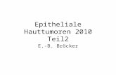 Epitheliale Hauttumoren 2010 Teil2 E.-B. Bröcker.