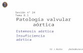 Patología valvular aórtica Estenosis aórtica Insuficiencia aórtica Sesión nº 24 Tema 8.1 Dr J.Barba jbarba@unav.es.