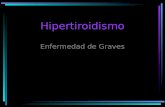 Hipertiroidismo Enfermedad de Graves. Receptor de TSH.