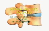 3.-Hernia Del Nucleo Pulposo Unjfsc