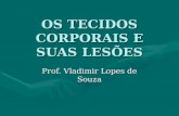 OS TECIDOS CORPORAIS E SUAS LESÕES Prof. Vladimir Lopes de Souza.