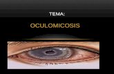 micologia oculomicosis