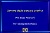 Tumore della cervice uterina Prof. Guido Ambrosini Università degli Studi di Padova.
