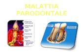 MALATTIA PARODONTALE. Patologia infiammatoria delle strutture anatomiche di sostegno del dente gengiva legamento parodontale osso alveolare cemento radicolare.