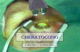 CHERATOCONO CROSS – LINKING. CHERATOCONO Malattia a lenta evoluzione Assottigliamento e sfiancamento della cornea con conseguente astigmatismo miopico.