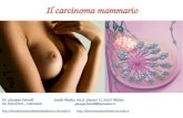 Il carcinoma mammario Dr. Giuseppe Fariselli Studio Medico, via G. Giacosa 71, 20127 Milano Tel. 0226143258 – 3388198646 giuseppe.fariselli@fastwebnet.it–
