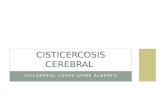 Cisticercosis Cerebral