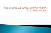 Transjugular intrahepatic porto systemic shunt