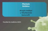 Filariasis linfática