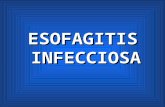 Esofagitis infecciosa expo
