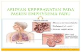 Emphysema paru